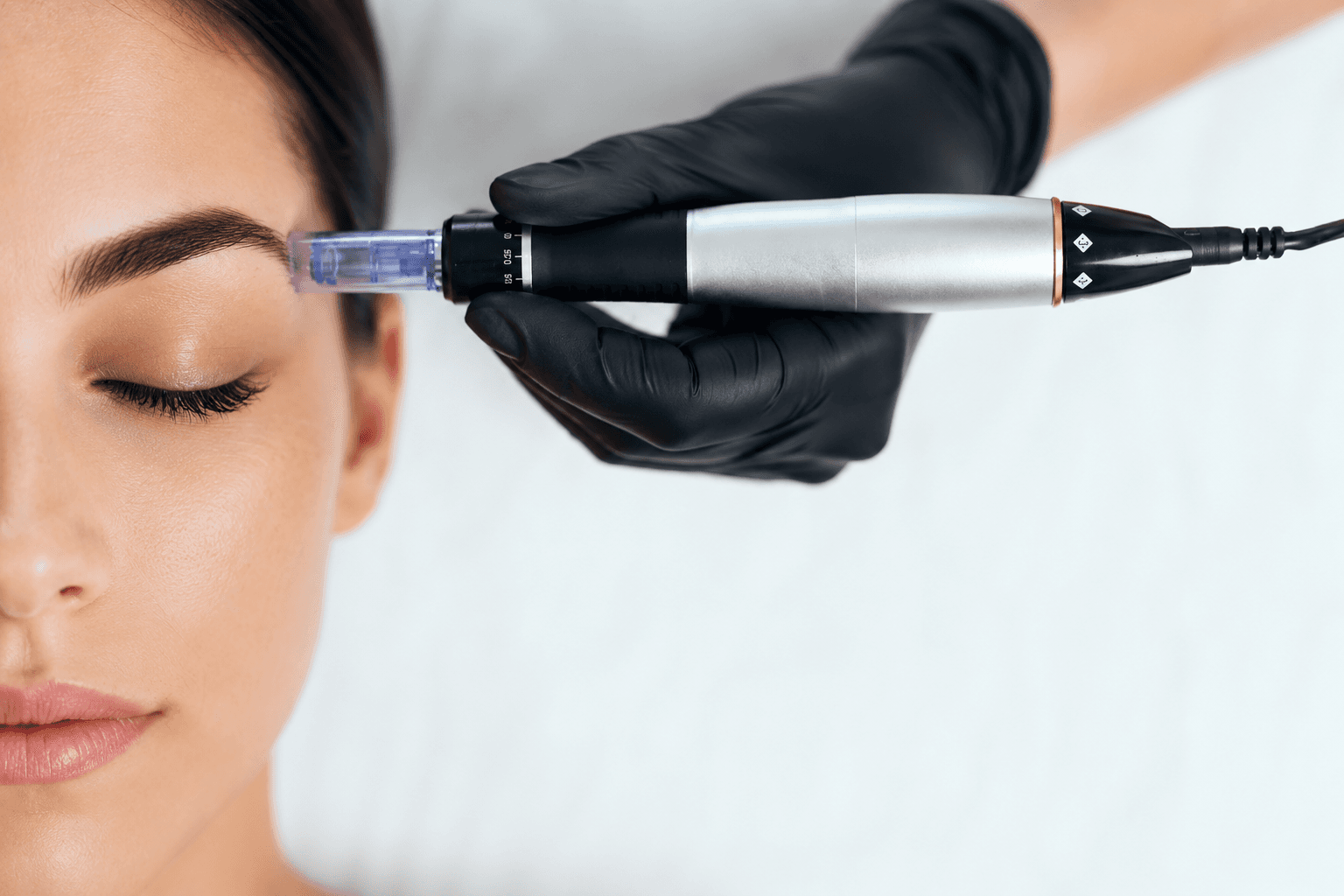 Microneedling with exosome therapy at UR ALLURE, Orange County