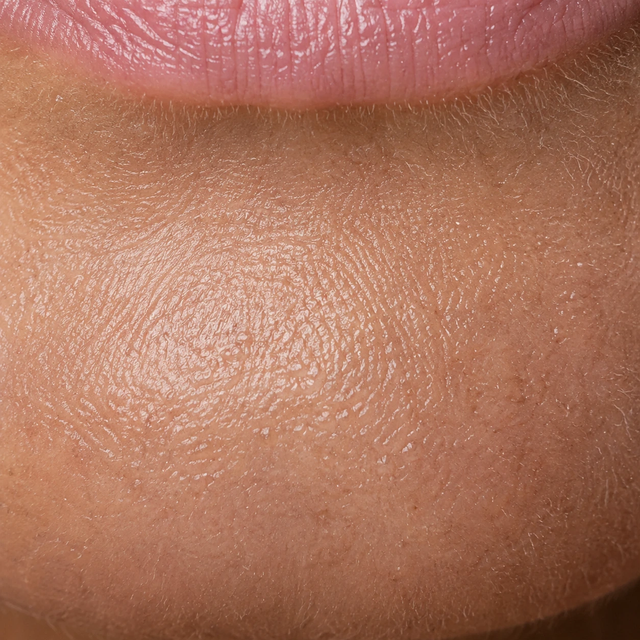 Illustrative chin close-up with rough microtexture and fine dry flakes. Not a client result.